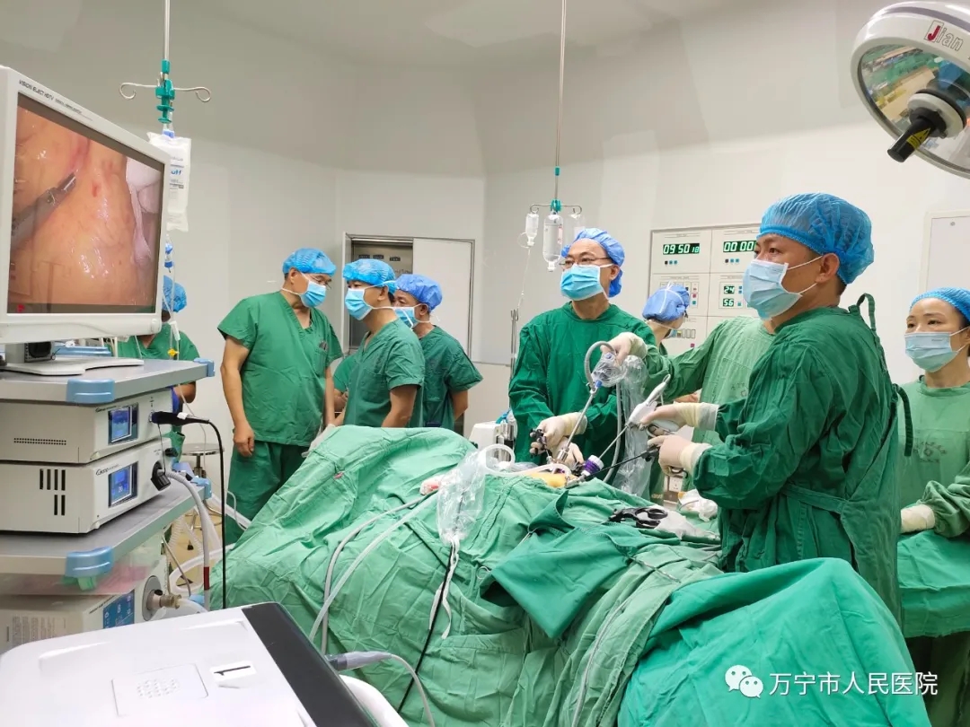 普通外科腹腔镜微创手术已成熟开展